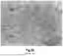 Fig. 08 - BENDABLE TITANIUM-ALLOY IMPLANTS, AND RELATED SYSTEMS AND METHODS