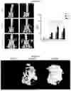 Fig. 06 - COMPOSITE MATRIX USEFUL FOR PROMOTING INNERVATION, OSTEOGENESIS AND ANGIOGENESIS