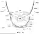 Fig. 07 - PATIENT INTERFACE