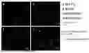 Fig. 01 - METHOD FOR DIRECT TRANSDIFFERENTIATION OF SOMATIC CELL