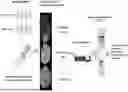 Fig. 01 - BIOMARKER FOR PREDICTING IMMUNOTHERAPEUTIC RESPONSIVENESS BASED ON SPATIAL TRANSCRIPTOME ANALYSIS AND USES THEREOF