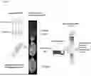 Fig. 02 - BIOMARKER FOR PREDICTING IMMUNOTHERAPEUTIC RESPONSIVENESS BASED ON SPATIAL TRANSCRIPTOME ANALYSIS AND USES THEREOF