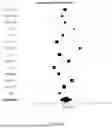 Fig. 48 - USE OF IMMUNE CELL-SPECIFIC GENE EXPRESSION FOR PROGNOSIS OF PROSTATE CANCER AND PREDICTION OF RESPONSIVENESS TO RADIATION THERAPY