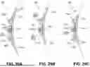 Fig. 17 - WIDE RANGE TAPPING SLEEVE