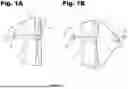Fig. 02 - ADJUSTABLE APERTURE AXIS PEEP SIGHT DEVICE