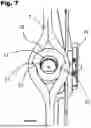 Fig. 08 - ADJUSTABLE APERTURE AXIS PEEP SIGHT DEVICE