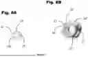 Fig. 09 - ADJUSTABLE APERTURE AXIS PEEP SIGHT DEVICE