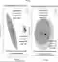 Fig. 04 - Method of Diagnosing and Treatment of Crohn's Disease and Ulcerative Colitis