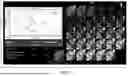 Fig. 08 - SYSTEM AND METHOD FOR ONE-SHOT AUTOMATIC TI PREDICTION FOR CARDIAC MRI