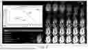Fig. 09 - SYSTEM AND METHOD FOR ONE-SHOT AUTOMATIC TI PREDICTION FOR CARDIAC MRI