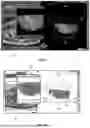 Fig. 06 - METHOD FOR GENERATING A SIMULATED BIDIMENSIONAL IMAGE OF A PORTION OF A PATIENT'S BODY