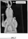 Fig. 03 - Systems and Methods for Identifying Radiation Events in Radiographs