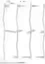 Fig. 09 - ARRAY SUBSTRATE, DISPLAY PANEL, AND DISPLAY APPARATUS